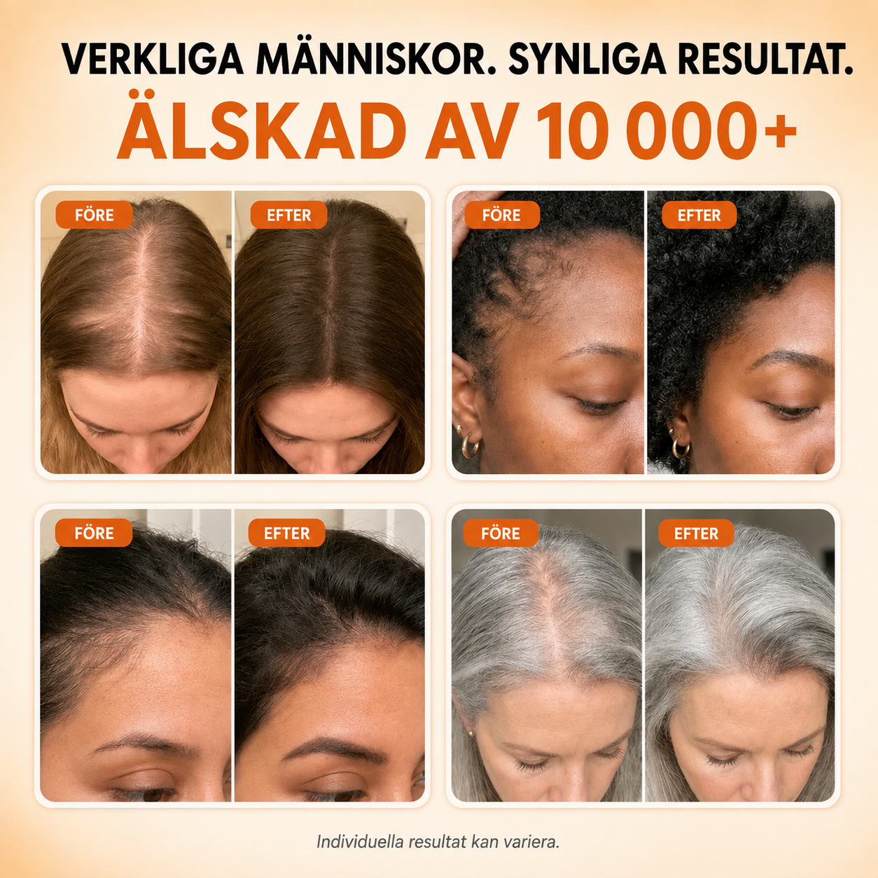 REVINA Hårväxtserum – För Fylligare & Starkare Hår